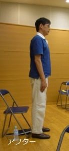 アフター